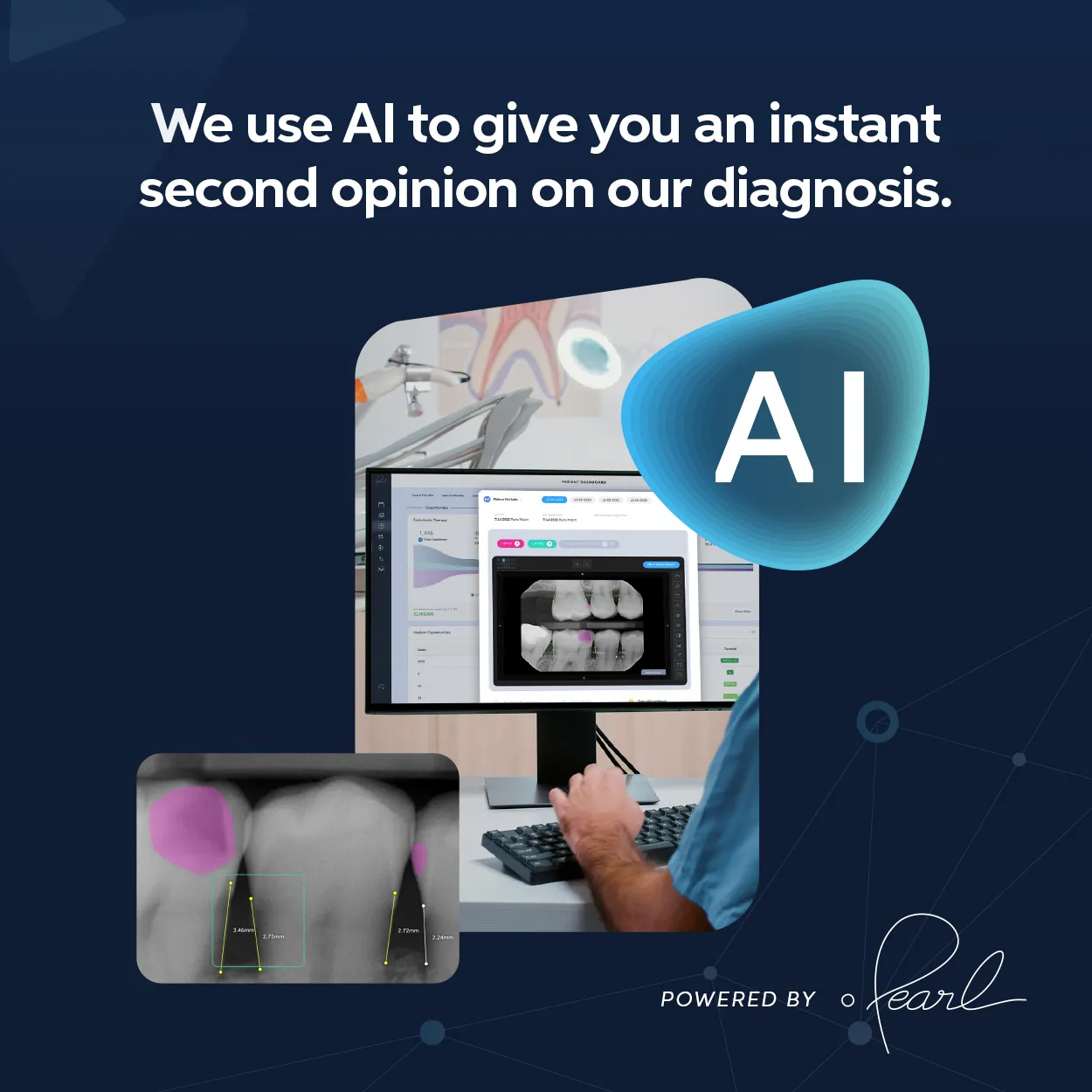 Pearl AI dental X-ray analysis showing AI-assisted diagnosis at Pybus Dental
