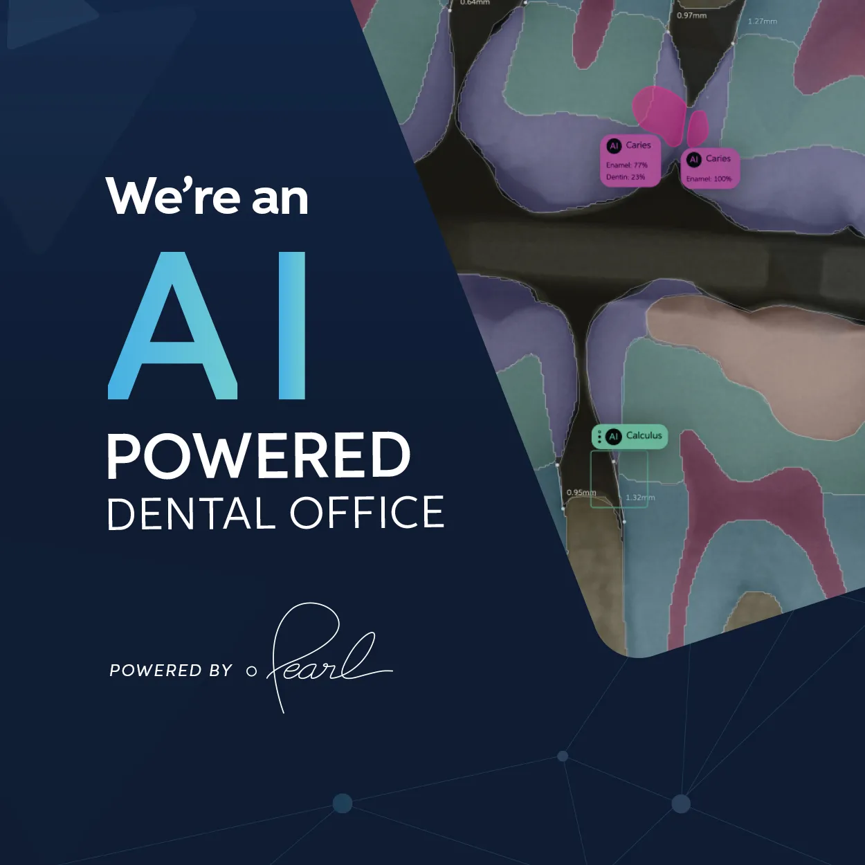 AI-powered dental office using Pearl AI to detect caries and calculus on dental X-rays